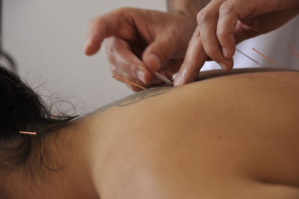 medicina-chinesa-acunpuntura-lisboa